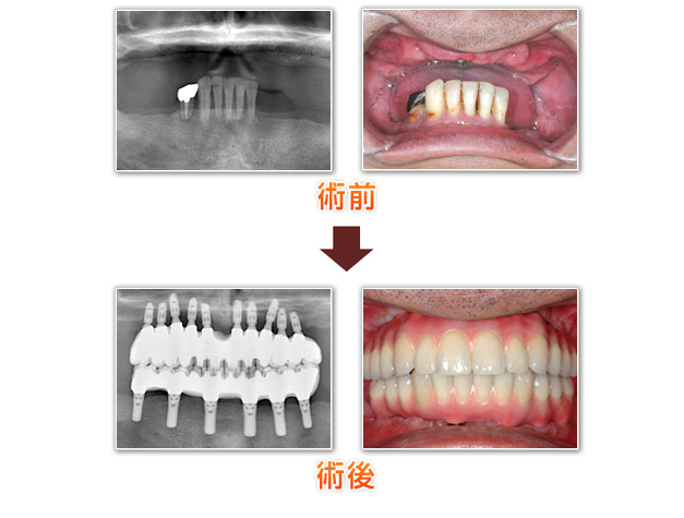 治療例紹介